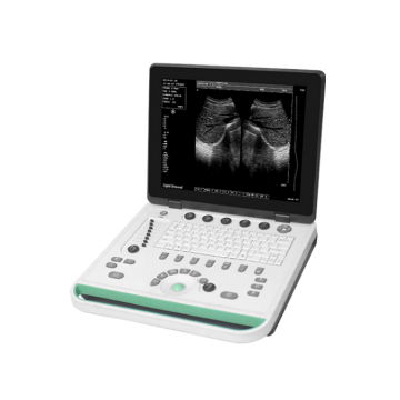 Laptop 15 inch screen ultrasound scanner